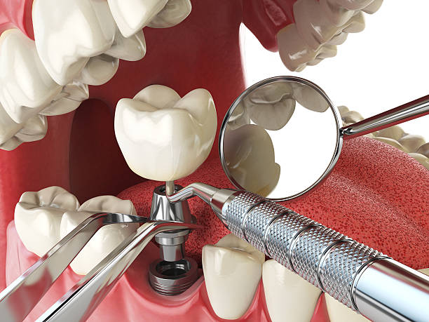 Best Emergency Dental Care for Broken or Chipped Teeth in Munford, TN