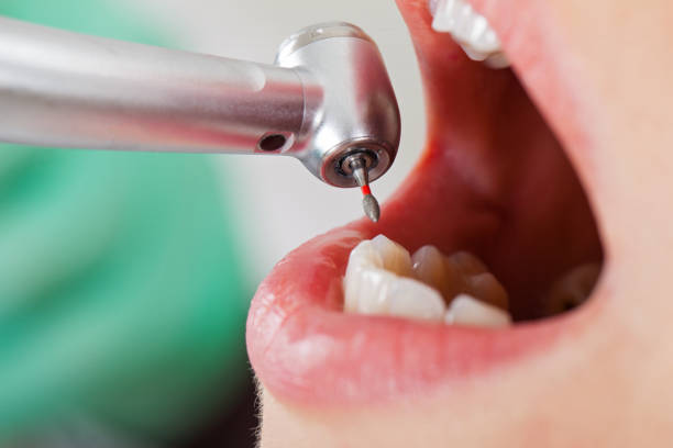 Best Emergency Treatment for Dental Infections or Abscesses in Munford, TN